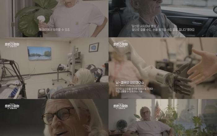 '텔레파시' 능력 얻은 사지마비 환자, 뿔 두 개 달고 로봇 팔로 운전까지...